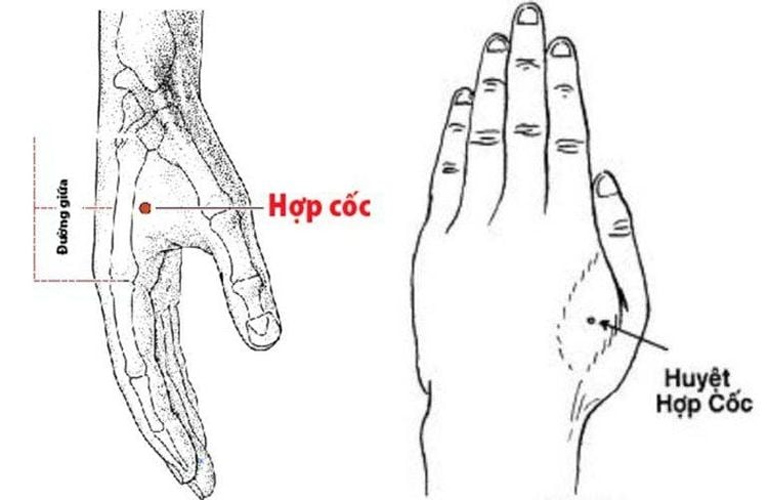 Huyệt Hợp Cốc thuộc kinh Thủ Dương Minh Đại tràng