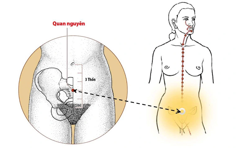 Phối huyệt Quan Nguyên giúp bổ thận, tráng dương